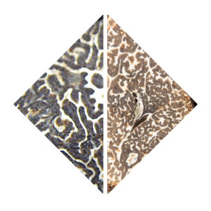 Unterschied Wintertrüffel Wintertrüffel Unterschiede